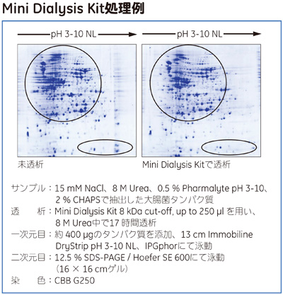 Mini Dialysis Kit処理例