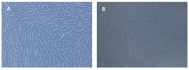 Parallel cultivation of bone marrow derived hMSC was performed on cells at passage 4 after isolation, after being frozen at passage 2, thawed and cultivated for two additional passages. (A) Bone marrow derived hMSC grown in Xuri MSC Medium at end of second passage. (B) Bone marrow derived hMSC grown in αMEM containing FBS at end of second passage. Parallel cultivation of bone marrow derived hMSC was performed on cells at passage 4 after isolation, after being frozen at passage 2, thawed and cultivated for two additional passages. (A) Bone marrow derived hMSC grown in Xuri MSC Medium at end of second passage. (B) Bone marrow derived hMSC grown in αMEM containing FBS at end of second passage.