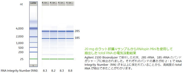 RNAspinで精製したtotal RNAの電気泳動図