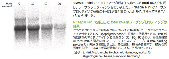 ノーザンブロッティングにも使用できる高純度total RNAが抽出できました