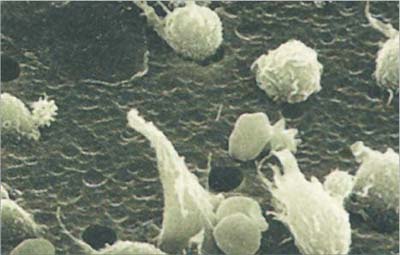 Chemotaxis Membrane