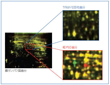 オルガネラ分画によるスポット検出の違い