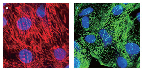 心筋マーカーを発現している心筋細胞の画像。
