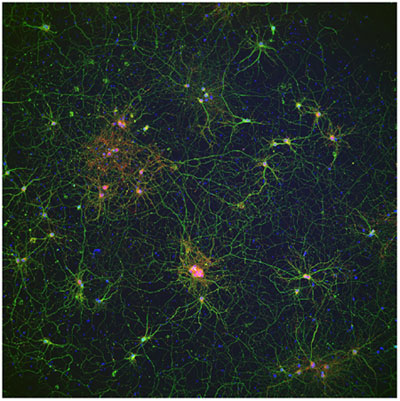 ラット海馬ニューロンの画像