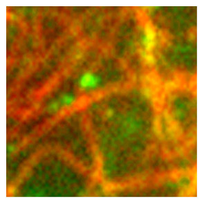 図1. 正常型プリオンタンパク質が微小管に沿って移動する様子