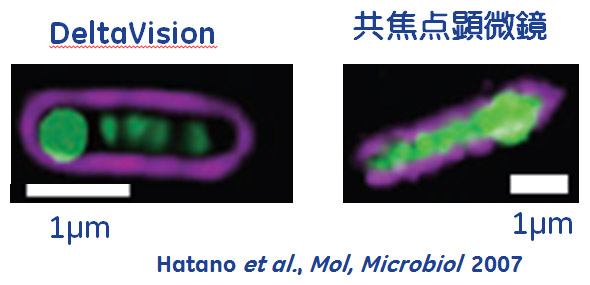 図1. 大腸菌内のプラスミド分配（SopA-GFP融合タンパク質）の繊維状の局在