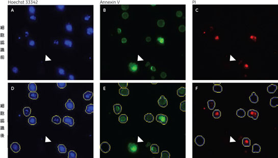 図3　画像解析ソフトウェアIN Cell Investigator Softwareによる画像認識