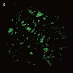 （B）Oct4画像 （幹細胞コロニー）