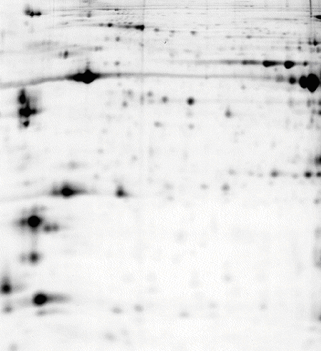 Mouse skeletal muscle, pH 3-10 NL IPG strip, 8 M urea lysis bufferのゲルイメージ