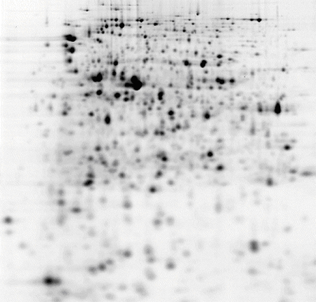 Escherichia coli (E.coli) cell culture, pH 3-10 NL IPG stripのゲルイメージ