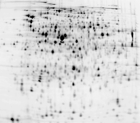 Escherichia coli (E.coli) cell culture, pH 4-7 IPG stripのゲルイメージ